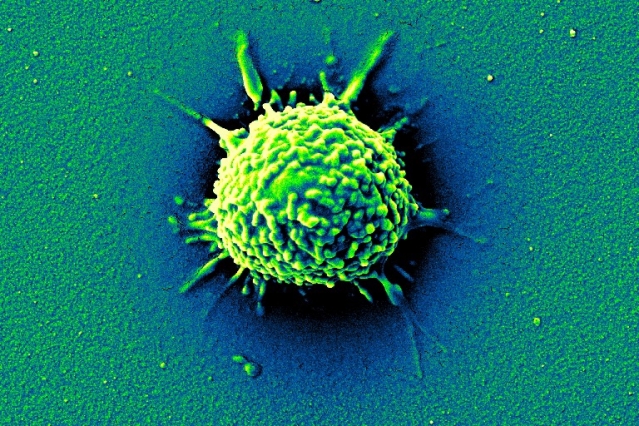 Image of white blood cell