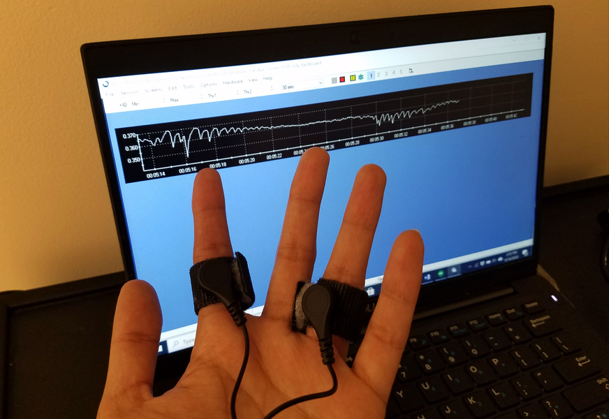 Electrodes attached to fingers