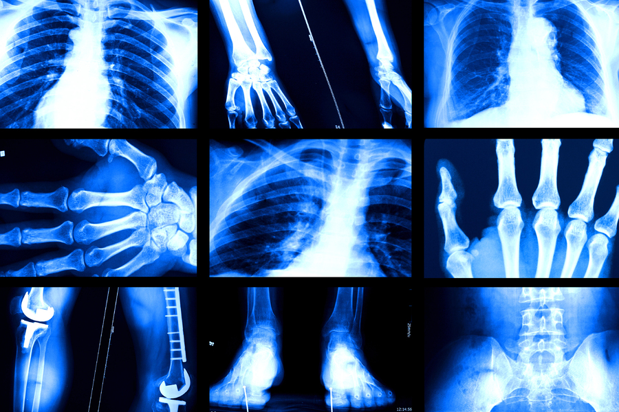 a selection of random x-ray images